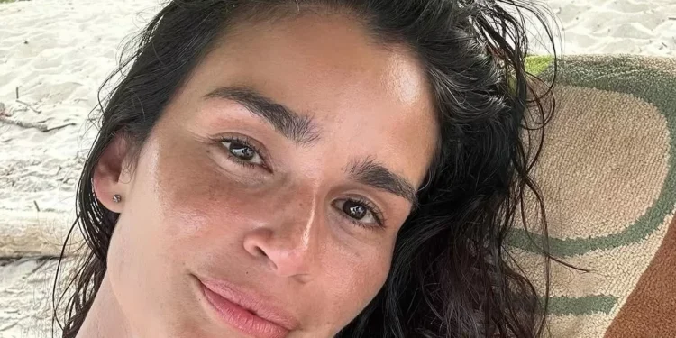 ‘O diagnóstico de esclerose múltipla me ensinou a ser menos controladora’, diz a top model Carol Ribeiro