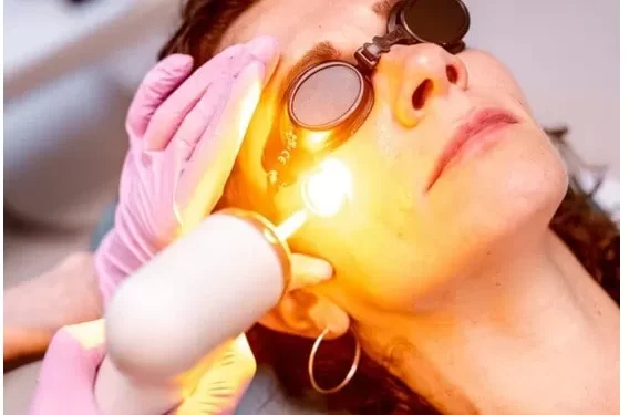 Por que a luz amarela faz bem para a beleza da pele?